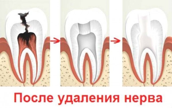 Что делать, если очень сильно болит зуб