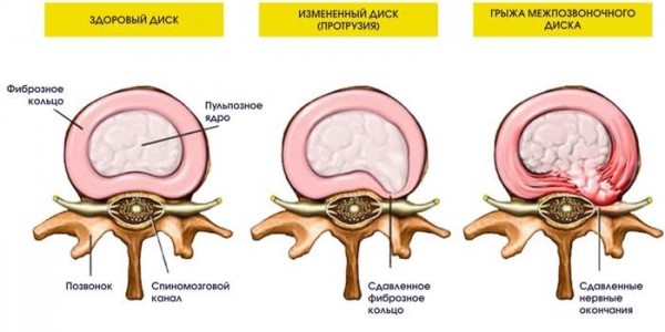 Калланетика для начинающих: польза для здоровья и похудения