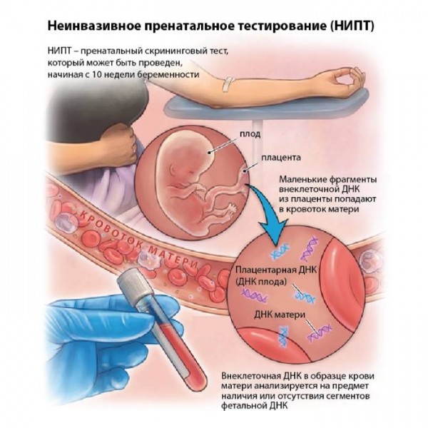 Как определить пол будущего ребенка