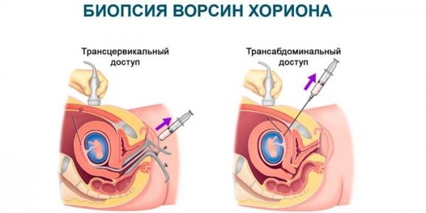 Как определить пол будущего ребенка